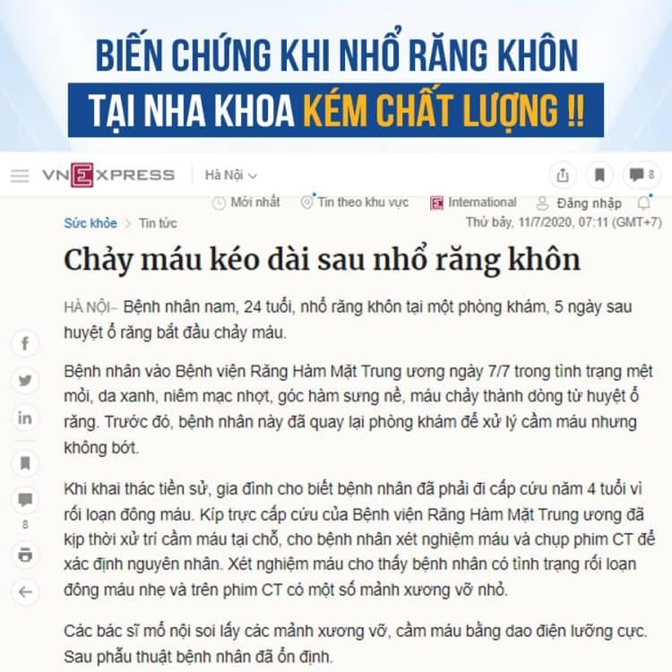 nho-rang-khon-vidental-10-750x750