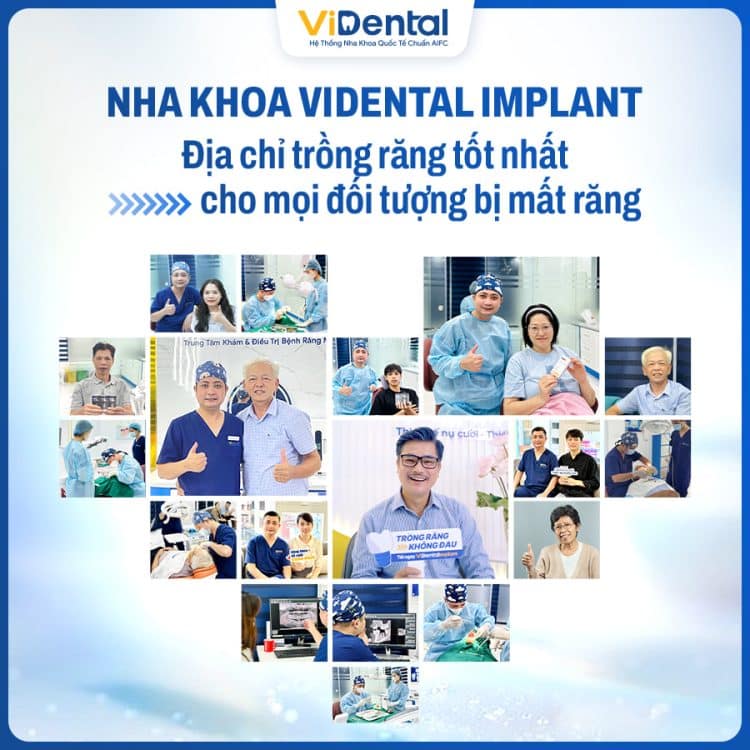 Banner Dịch Vụ Trồng Răng Implant Tại Nha Khoa Guva Dental 1