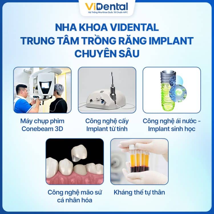 Banner Dịch Vụ Trồng Răng Implant Tại Nha Khoa Guva Dental 7