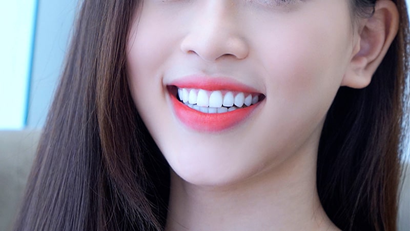 Lấy Cao Răng Bằng Chanh