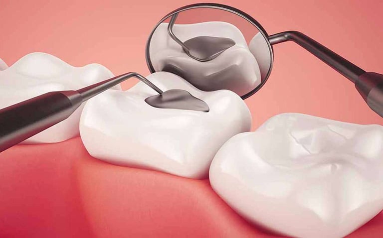 Điều Trị Tủy Răng Phú Nhuận