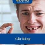 Gãy Răng