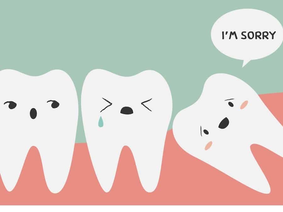 Nhổ Răng Khôn Giá Rẻ Có An Toàn Không? Những Điều Cần Lưu Ý Khi Lựa Chọn