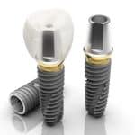 Trụ Implant Đức