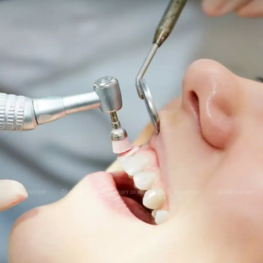 Giá lấy cao răng tại các phòng khám nha khoa ở Bình Thạnh