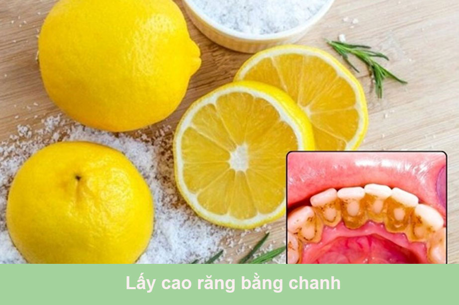 Tác Dụng Của Chanh Trong Việc Loại Bỏ Cao Răng
