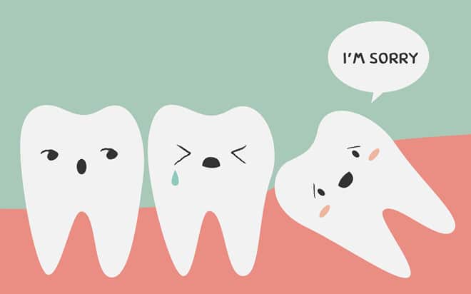Tại sao nên chọn phòng khám chuyên nghiệp để nhổ răng khôn ở TP.HCM?