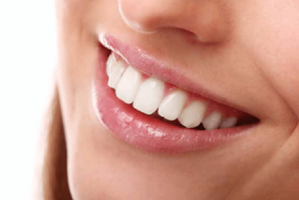 Lấy cao răng có ảnh hưởng đến sức khỏe tổng thể không?