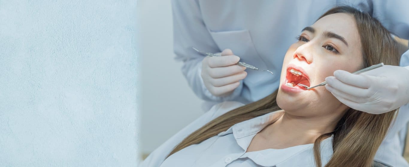 Nhổ răng khôn an toàn tại Guva Dental