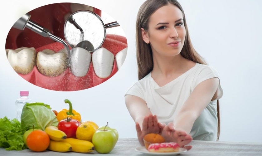 Thực đơn sau khi lấy cao răng: Những món ăn mềm dễ tiêu