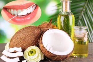lấy cao răng bằng dầu dừa