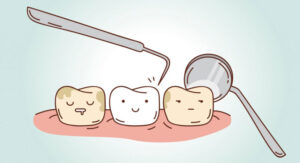 lấy cao răng có làm thưa răng không