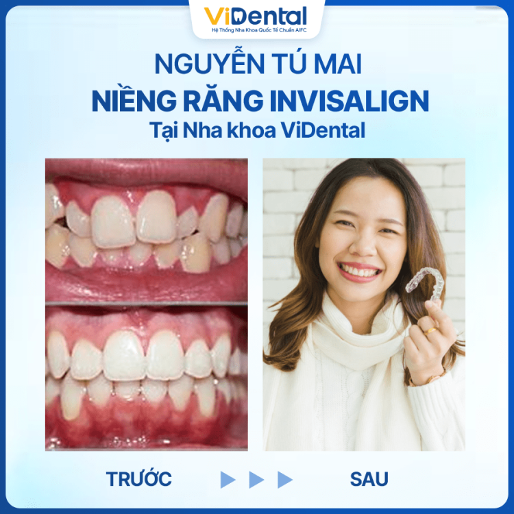 Khách hàng Nguyễn Ngân Thương