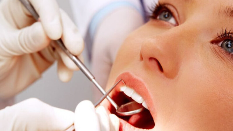 Trám Răng Thẩm Mỹ Tại Guva Dental – Giá Tốt, Thẩm Mỹ Cao