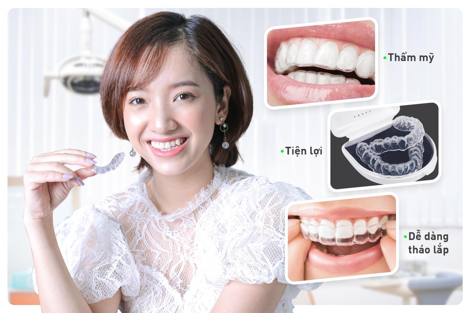 Chi Phí Niềng Răng Invisalign – Đầu Tư Dài Hạn Cho Nụ Cười Hoàn Hảo 4 Có Nên Đầu Tư Vào Niềng Răng Invisalign?