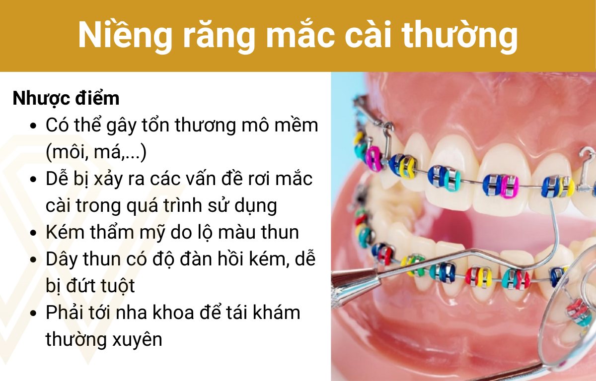 3 nhược điểm chính cần cân nhắc