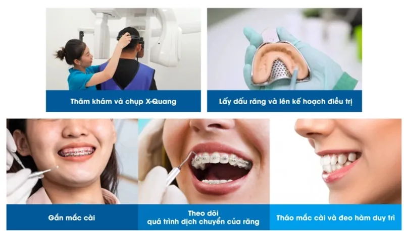 5 bước quy trình điều trị chuẩn