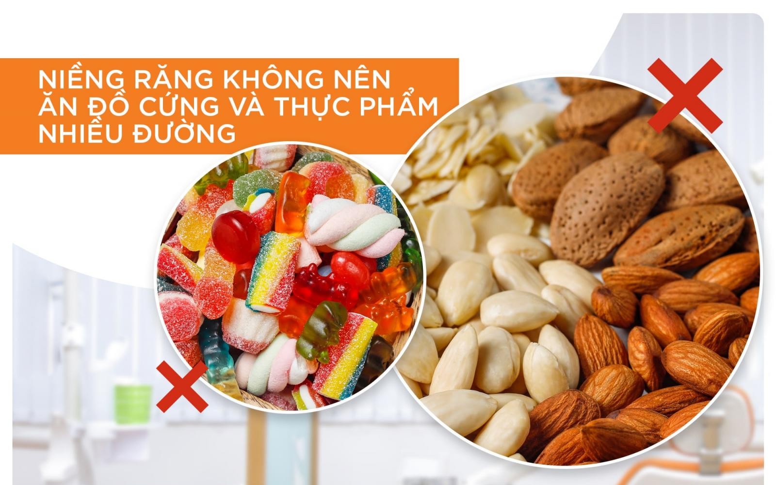 Lưu ý nghiêm ngặt về chế độ ăn uống khi niềng mắc cài kim loại