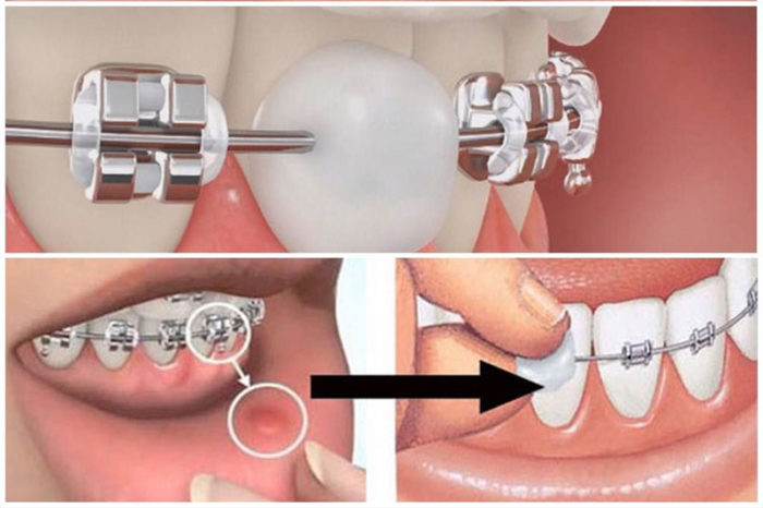 Xử lý tình huống khẩn cấp