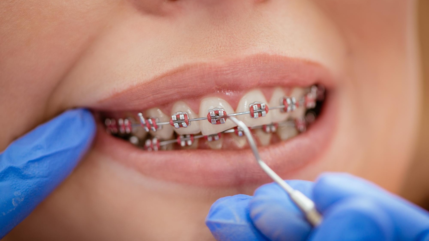 Chuẩn bị và những điều cần lưu ý trước mỗi buổi tái khám