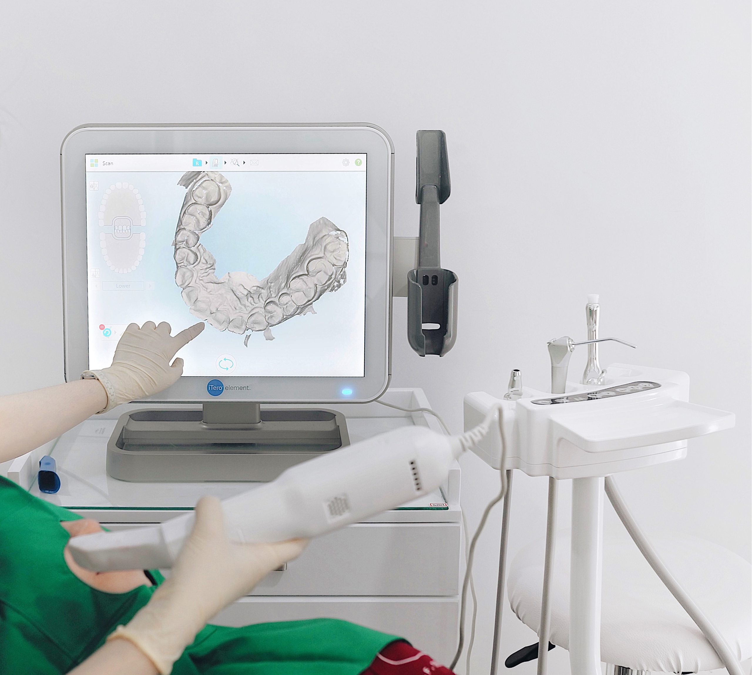 Chụp X-quang và lấy dấu răng 3D